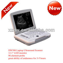 DW-500 máquinas de ultrasonido para portátiles y portátiles médicos usb para abdomen, vejiga, embarazo, riñón, hígado